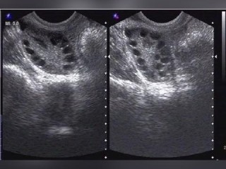 身体保养项目有哪些？