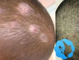 头皮学院有哪些