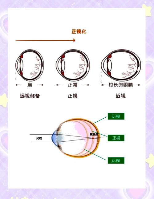 视力问题有哪些商机