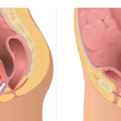 护理名称有哪些？