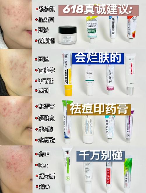 美容院祛痘产品有哪些