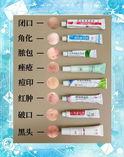 美容院祛痘产品有哪些