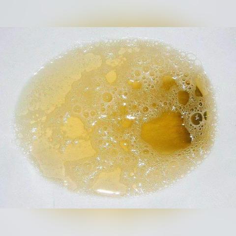 美容院美白项目有哪些