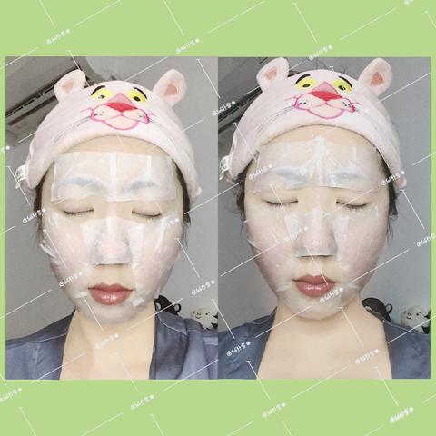 韩国皮肤管理项目有哪些？