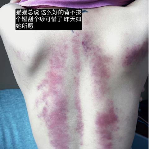 身体保养项目有哪些? 身体保养项目有哪些?